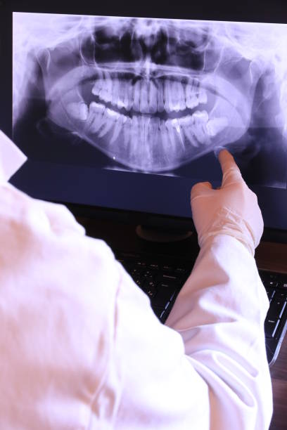 Best Dental Abscess Treatment in Lakeport, TX