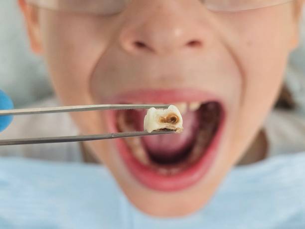 Best Emergency Treatment for Jaw Pain or Injury in Lakeport, TX